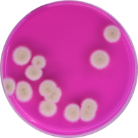 Detecting Microbial Contamination in Cannabis